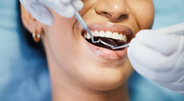Best Knocked-Out Tooth Emergency  in Sweetser, IN